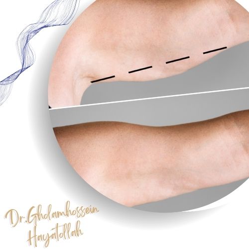 معایب و خطرات احتمالی