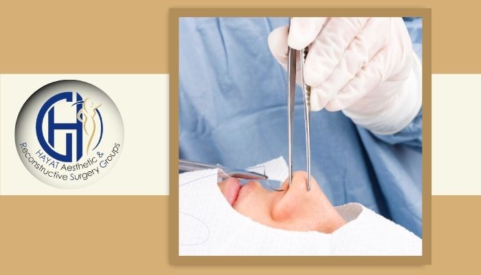 چگونه خطرات رینوپلاستی را کاهش دهیم؟