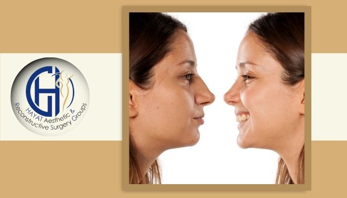 مقایسه از نظر ویژگی‌های ظاهری