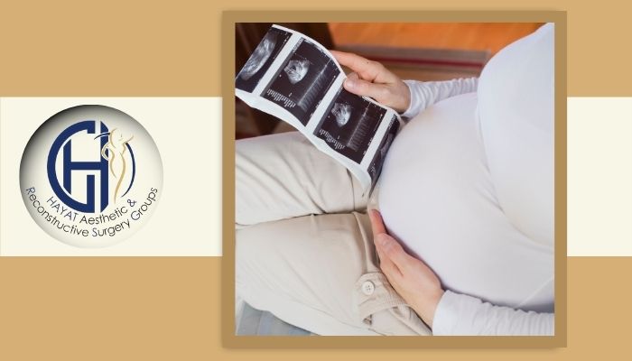 آیا بارداری بعد از پیکرتراشی خطرناک است؟ 