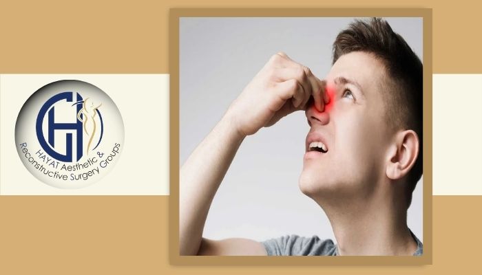 چه زمانی باید به پزشک اطلاع دهید؟