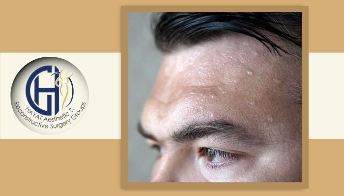 آیا تزریق بوتاکس جلوی تعریق بیش از حد را می گیرد؟