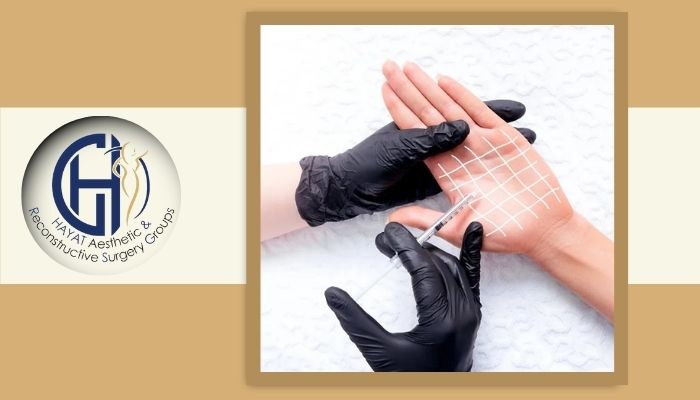 مراحل تزریق بوتاکس برای درمان تعریق