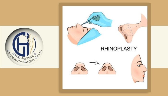 مهمترین مشکلات تنفسی مرتبط با بینی مهمترین مشکلات تنفسی مرتبط با بینی