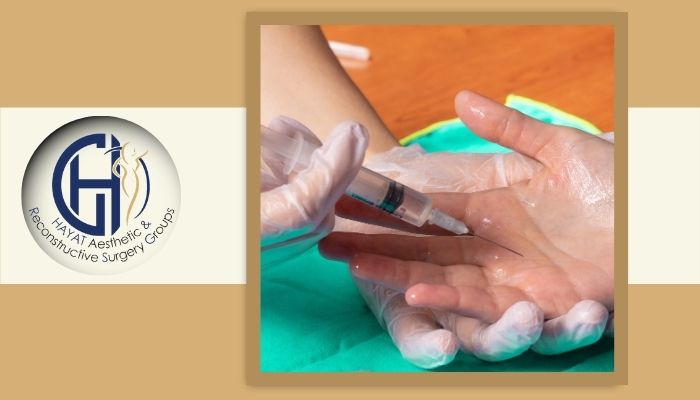 نقش بوتاکس در کنترل تعریق کف دست 