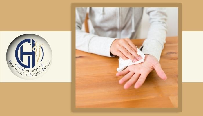 تعریق بیش از حد کف دست چرا ایجاد می‌شود؟