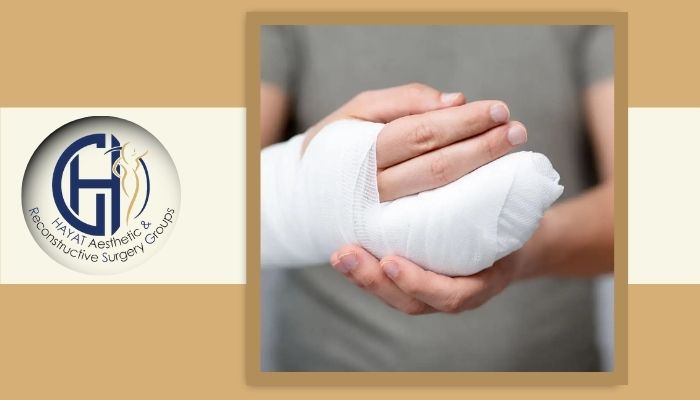 بعد از قطع انگشت می‌توان آن را دوباره پیوند زد؟