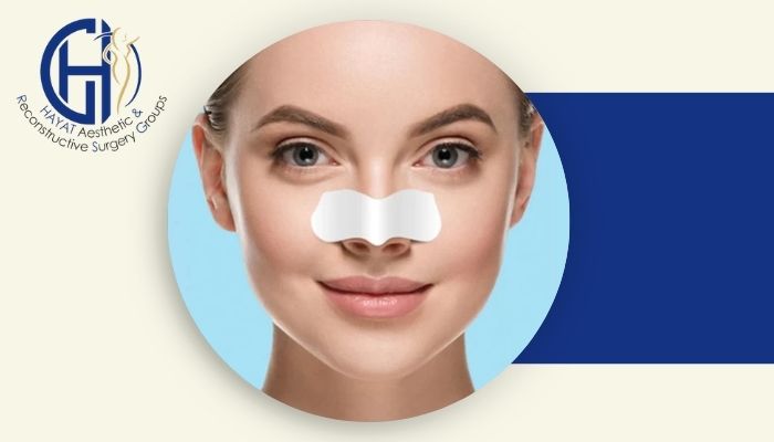 آیا چسب زدن طولانیمدت بینی بعد از عمل واقعاً ضروری است؟ آیا چسب زدن طولانیمدت بینی بعد از عمل واقعاً ضروری است؟