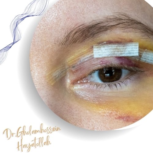 زمان مراجعه فوری به پزشک زمان مراجعه فوری به پزشک