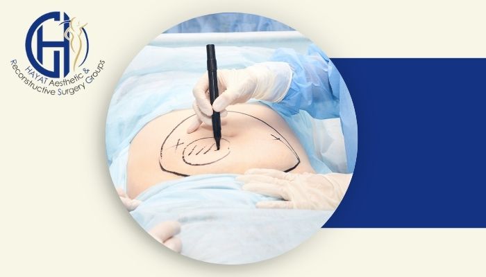 اسلیو معده بهتر است یا پیکرتراشی؟ مقایسه کامل این دو روش