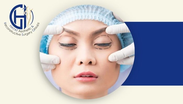 بعد از بلفاروپلاستی چه کرمی برای ترمیم پوست بهتر است؟
