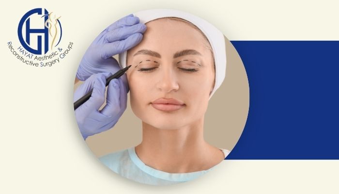 بهترین سن برای انجام جراحی بلفاروپلاستی چه زمانی است؟