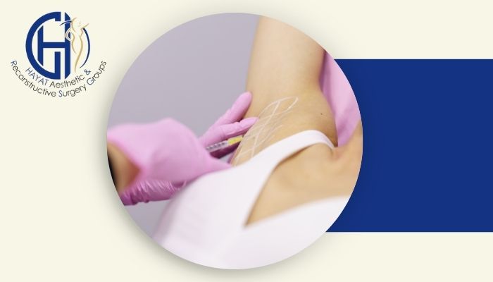 تزریق بوتاکس چگونه به درمان تعریق بیش از حد کمک می‌کند؟