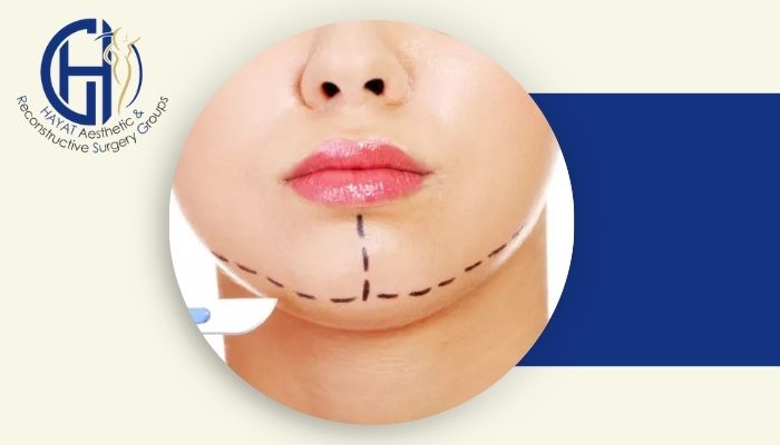 جراحی زیبایی فک چگونه است؟ عوارض و هزینه های جراحی