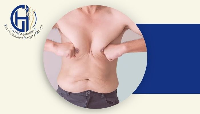 علت بزرگ شدن سینه در مردان چیست و چگونه درمان می‌شود؟