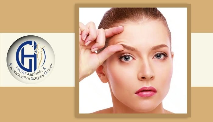 لیفت شقیقه چگونه انجام می شود؟
