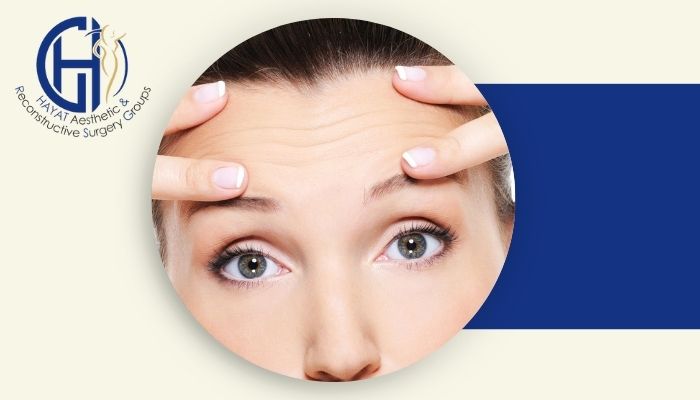 لیفت پیشانی و شقیقه چگونه است؟ انواع روش ها و ماندگاری آن ها