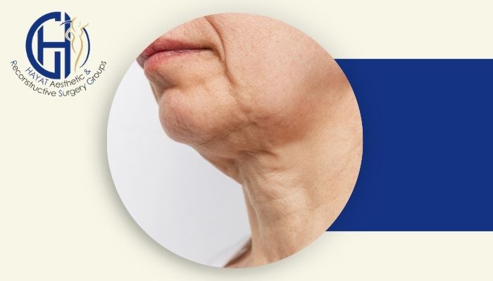 لیفت گردن چگونه انجام می‌شود؟ مزایا، روش‌ها و هزینه آن