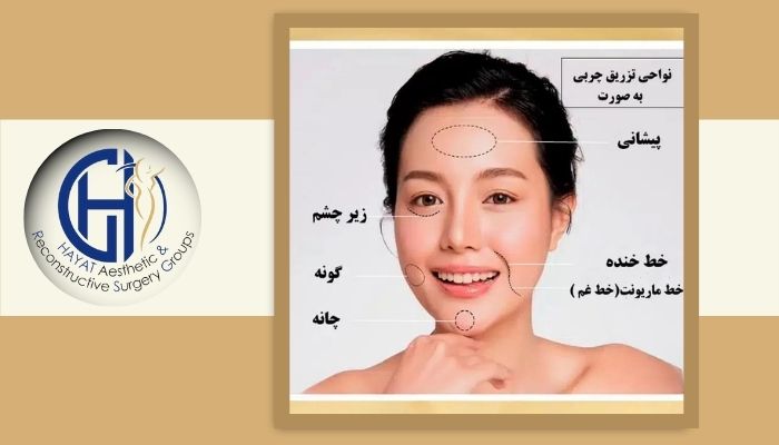 عوامل مؤثر بر طبیعی شدن ظاهر صورت